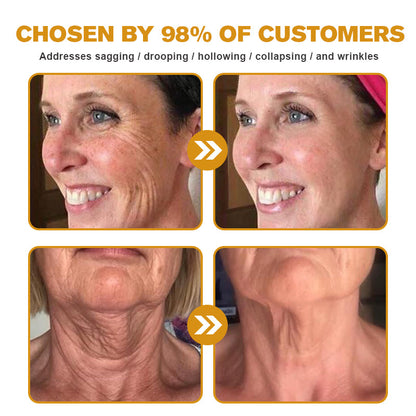 (Made and Shipped from USA) 🧑‍⚕️Pureluxo® Botox Bee Venom Wrinkle Removal Cream- LAST DAY 70% OFF✨